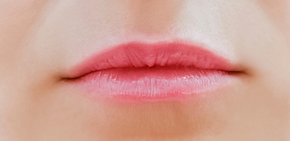 lips-before3-1.jpg