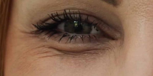 eyes